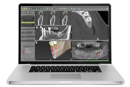 3Dシミュレーション